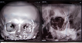 ����������� �������������������� ��������� �������������